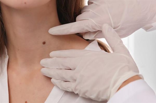 Dermatologia Cirúrgica | Sá & Chieppe Dermatologia